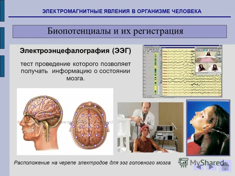 Регистрация активности мозга. Биопотенциалы головного мозга. Электроды ЭЭГ. Электрическая активность головного мозга. ЭЭГ биопотенциалы.
