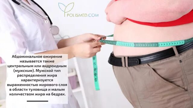 Абдоминальное ожирение. Абдоминальное ожирение у женщин. Ожирение по абдоминальному типу. Абдоминальный Тип ожирения характеризуется.