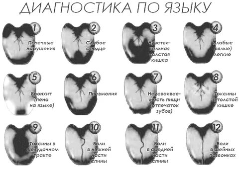 Язык признак какой болезни. Болезни по языку схема. Выявление болезней по цвету языками. Выявление заболевания по языку.