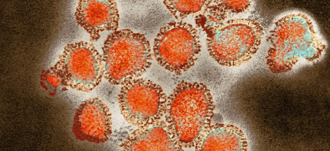Гонконг грипп симптомы. Вирус h3n2. вирус h3n2 гонконгский грипп. вирус гриппа h3n2. вирусы гриппа h2n2.