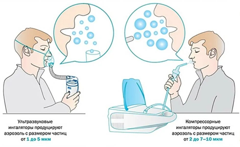 Когда делать ингаляцию