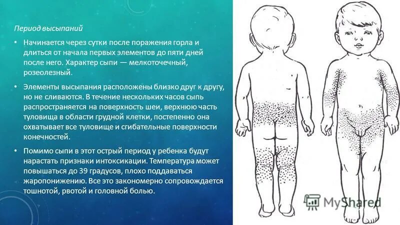 Сыпь при инфекционных заболеваниях у детей. Скарлатинозная краснуха. мелкоточечная петехиальная сыпь. детские заболевания с сыпью. сыпь при скарлатине сыпь.