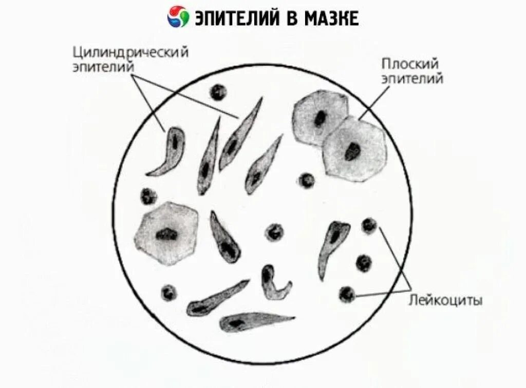 Плоский и цилиндрический эпителий в мазке. Гинекологический мазок эпителий плоский. Цилиндрический эпителий микроскопия. Эпителий в мокроте микроскопия. Эпителий клетки цилиндрического эпителия слизь