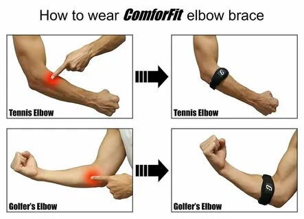 Elbow перевод