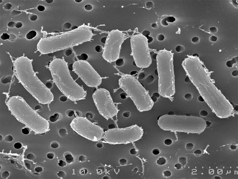 Лактобациллы (Lactobacillus). Lactobacillus Acidophilus в микроскопе. Thiobacillus бактерии. Кисломолочные бактерии лактобацилус.