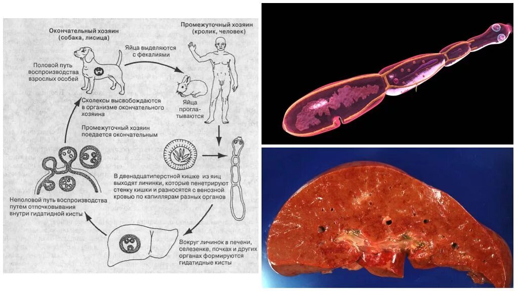 Альвеококкоз и эхинококкоз. Эхинококкоз личиночная стадия. Эхинококк печени цикл развития. Эхинококкоз пути заражения человека.