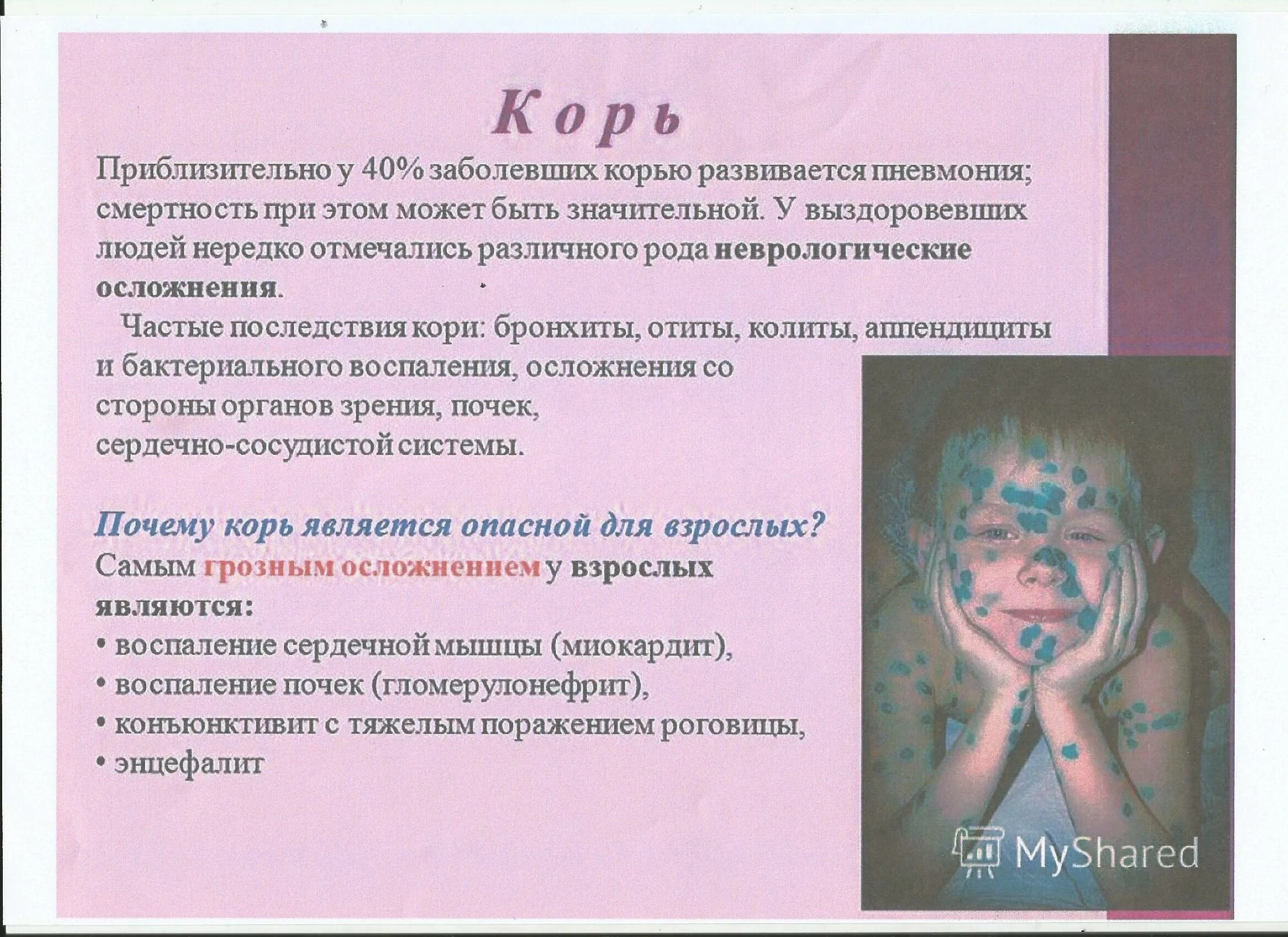 Возможные осложнения при кори. Планирование ухода при кори:. Причины смерти при кори. Корь потенциальные проблемы.