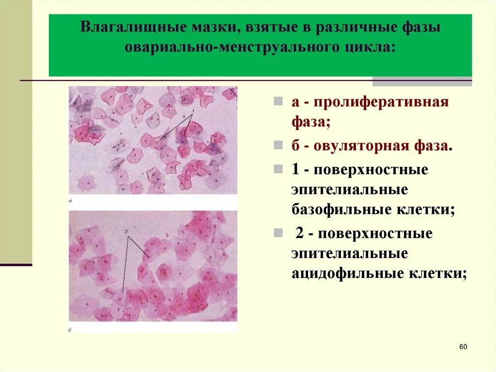 Изменение клеток матки. Клетки промежуточного типа. Клетки влагалищного эпителия в мазках. Тип цитологического влагалищного мазка. Микроскопия женского мазка.