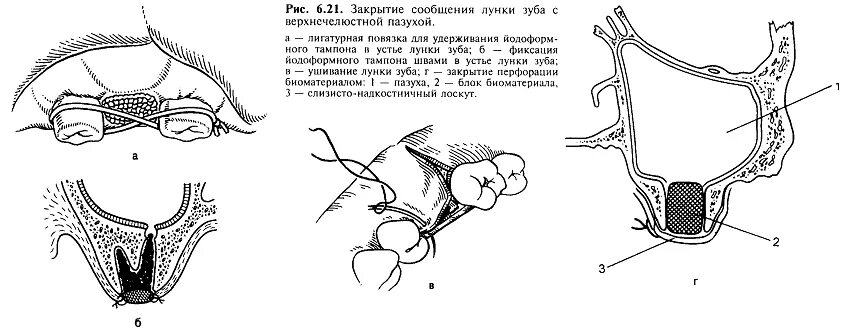Почему после закрытия