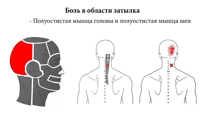 Головная в области затылка