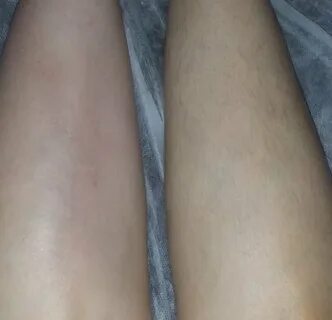 Депиляция волос ногах воском
