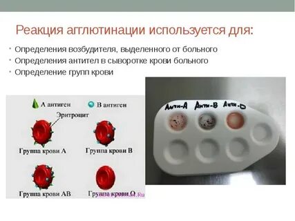 Антитела к антигенам сальмонелл