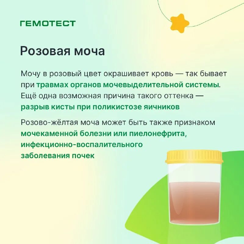 Что изменяет цвет мочи. Нормальный цвет мочи. Цвет мочи норма. Цвет мочи и заболевания. Почему моча меняет цвет.