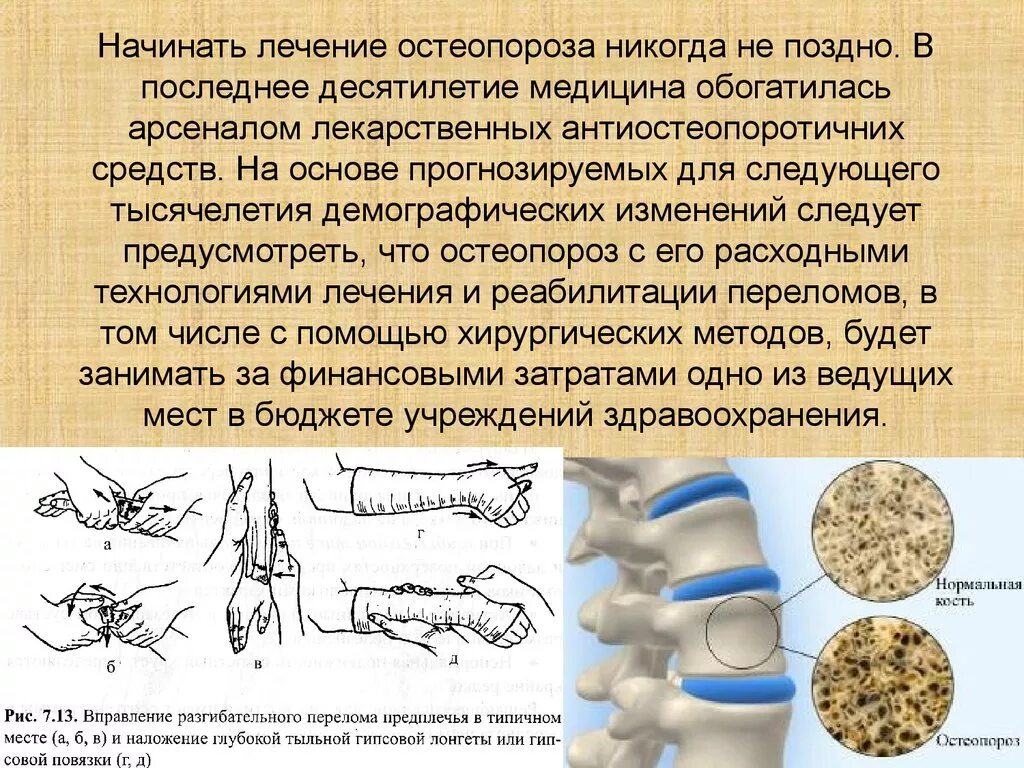 Болезнь остеопороз как лечить. Остеопороз лечение. остеопороз что это такое как лечить. методы лечения остеопороза. как лечится остеопороз.