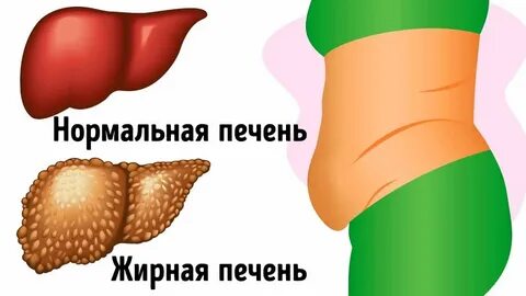 Увеличенная печень причины симптомы лечение