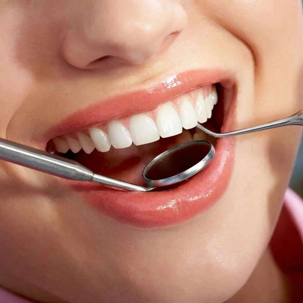 Гигиена полости рта стоимость. Профессиональная гигиена полости рта. Зубы стоматолог. Красивые зубы стоматология. Профессиональная гигиена зубов.