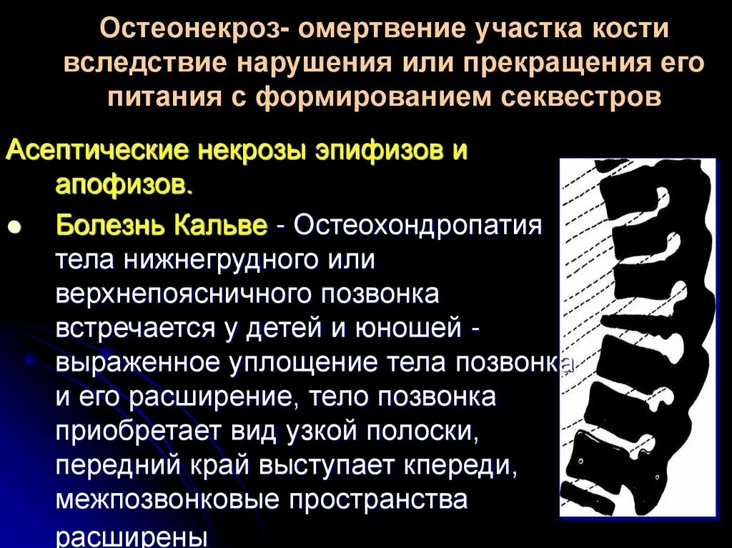 Степени асептического некроза на кт. Остеонекроз мкб. Классификация периодонтитов мкб. Остеомиелит классификация мкб 10. Остеонекроз классификация.
