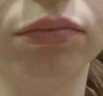 Полоски на губах
