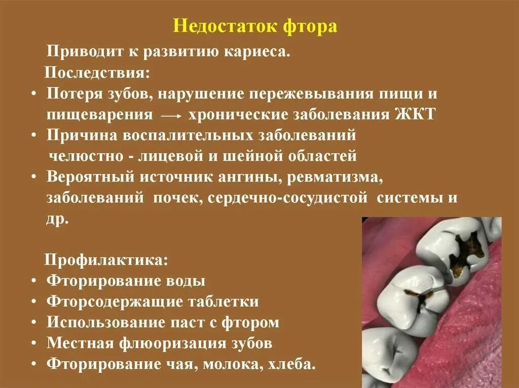 Хроническое заболевание полости. Заболевания при недостатке фтора. Недостаток фтора в организме. Недостаток фтора приводит к развитию. Недостаток фтора в организме развивается.