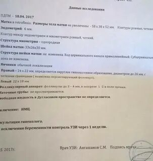 Дугласовое пространство у женщин