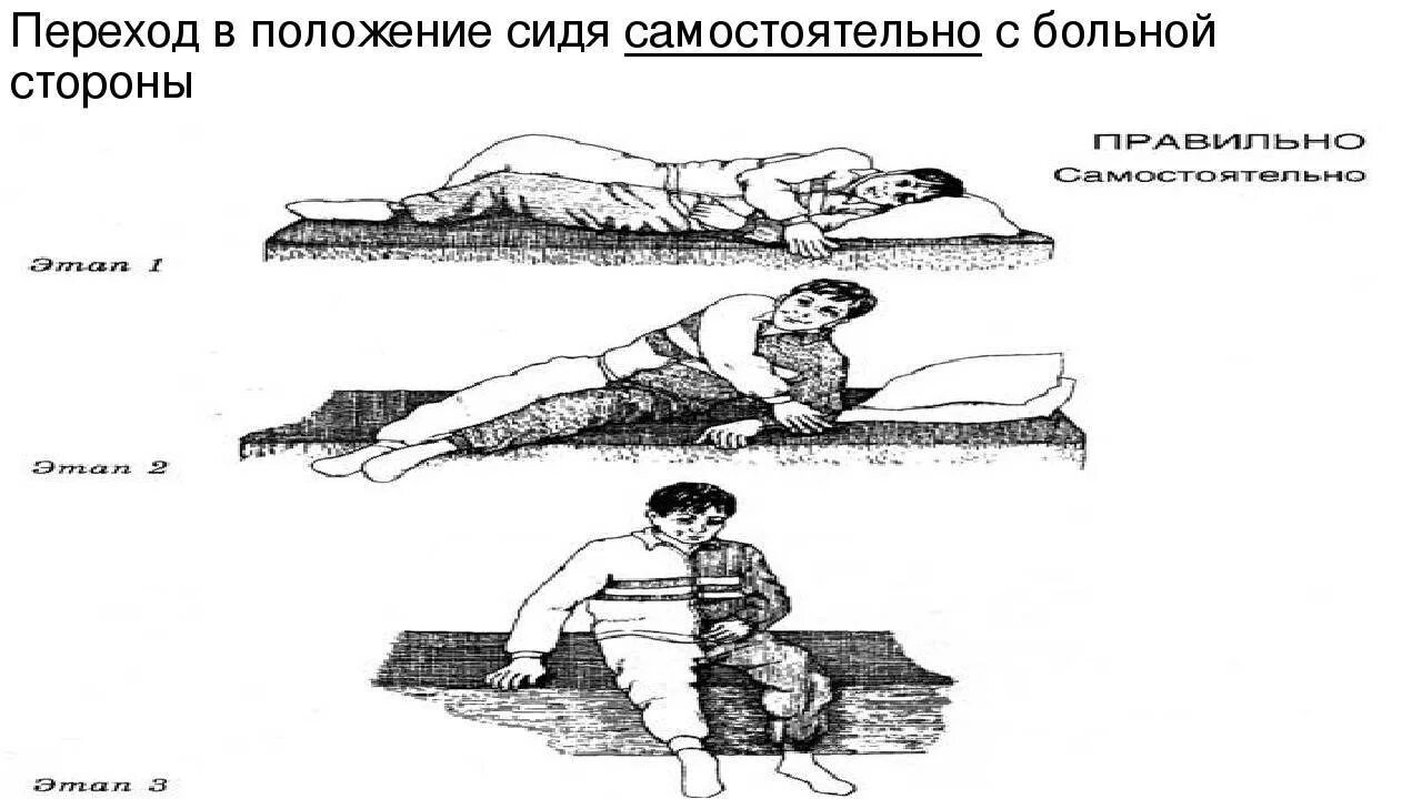 Инсульт паралич левой. Переход в положение сидя с больной стороны. Положение больного после инсульта. Положение пациента с инсультом. Положение пациента при параличе.