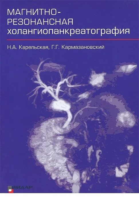 Магнитно резонансная холангиопанкреатография МРХПГ. Магнитно-резонансная холангиопанкреато- графия (МР-ХПГ). Магнитно-резонансная холангиопанкреатография (MRCP, МРХПГ). Кармазановский.