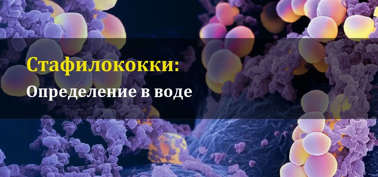 Стафилококк в воде. Стафилококк в воде