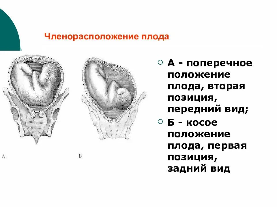Членорасположение положение предлежание плода. Передний вид плода. предлежание положение и позиция. поперечное положение плода.