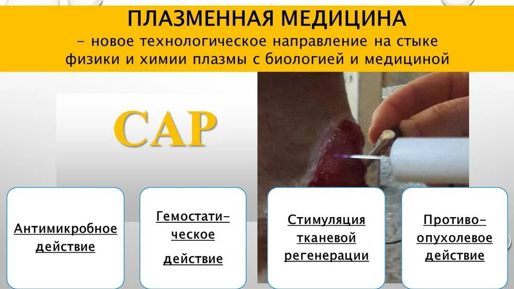 Плазма химический процесс. Использование плазмы. Плазма физика. Плазма химический процесс. Применение плазмы в медицине.