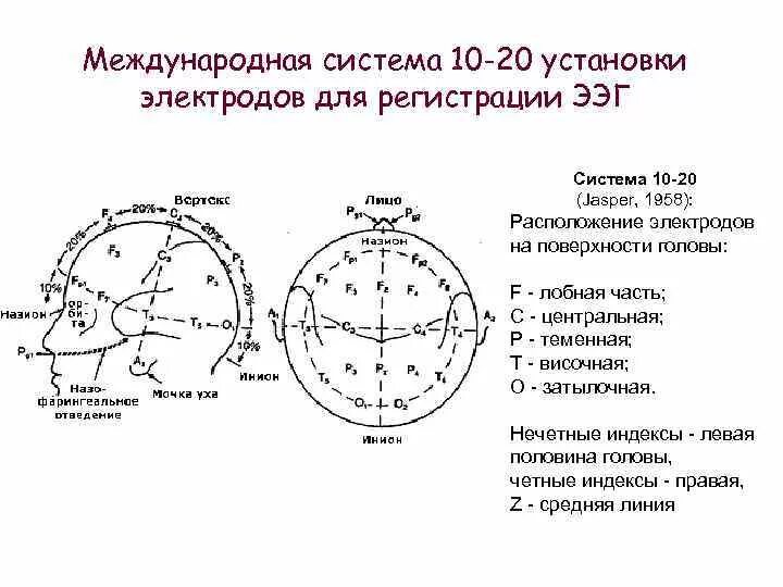 Схема наложения электродов ЭЭГ. Схема наложения электродов при ЭЭГ 10-20. Расположение электродов при ЭЭГ система 10 20. Схема расположения электродов 10-20 ЭЭГ.