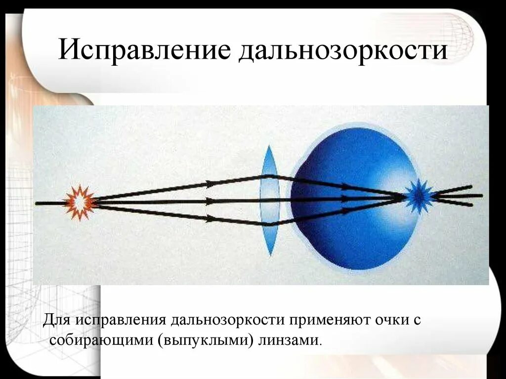 Линзы для коррекции дальнозоркости физика. Для устранения дальнозоркости применяют очки с собирающими линзами. Для коррекции гиперметропии применяются линзы. Гиперметропия коррекция линзами. Линзы для зрения дальнозоркость