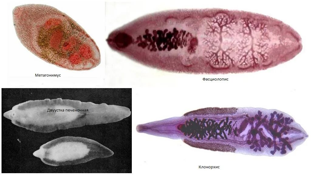 Двуустка печеночный сосальщик. Черви сосальщики. Представители сосальщики плоские черви. Паразитические черви сосальщики. Плоские черви (класс трематод);.