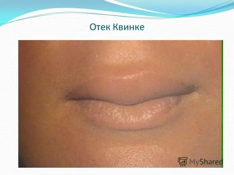 Как называется песня сашка квинке. Машка сашка гришка. Лсп текст. Как называется песня сашка квинке. Как называется песня сашка квинке.