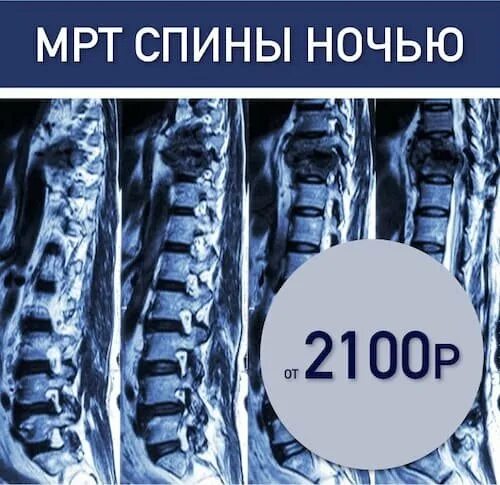 Мрт позвоночника в калининграде по дмс. Направление на мрт позвоночника. Мрт позвоночника в спб акция. Мрт позвоночника в спб акция. Мрт позвоночника в спб акция.