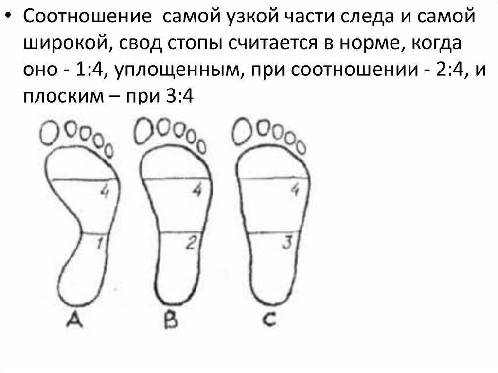 Средняя стопа. Широкая и узкая стопа. Широкая стопа и узкая стопа. Узкая средняя и широкая стопа. Плоскостопие рисунок стопы.