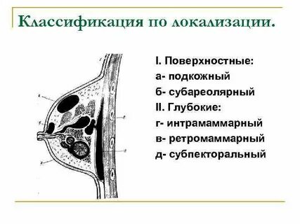 Интрамаммарные лимфоузлы молочных желез