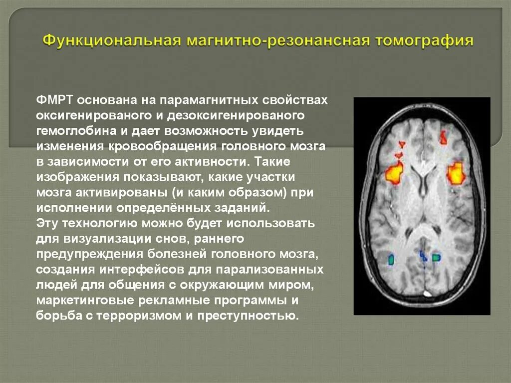 Функциональные состояния головного мозга. Функциональная магнитно-резонансная томография. Функциональная магнитно-резонансная томография головного мозга. Метод функциональной магнитно-резонансной томографии. Магнитно-резонансная томография метод исследования.