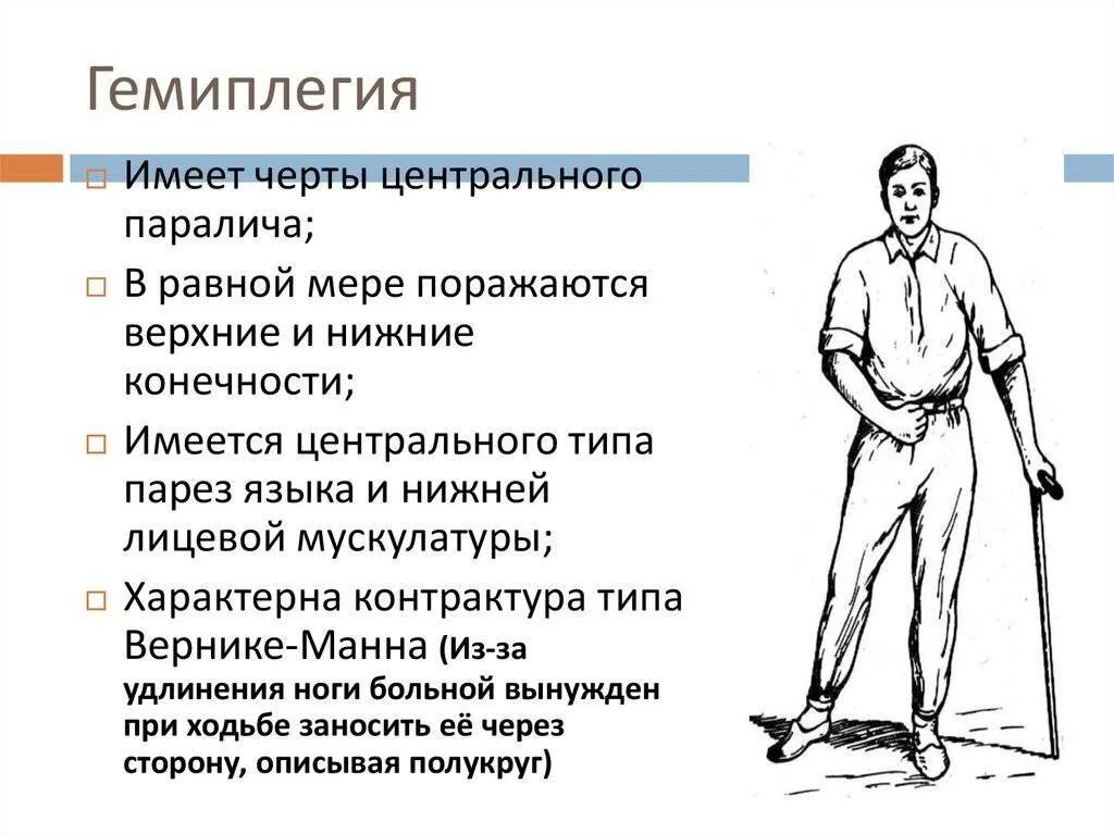 Инсульт паралич левой. ДЦП формы спастическая гемиплегия. Гемипарез локализация поражения. Спастическая гемиплегическая походка. Левосторонний Центральный гемипарез синдром.