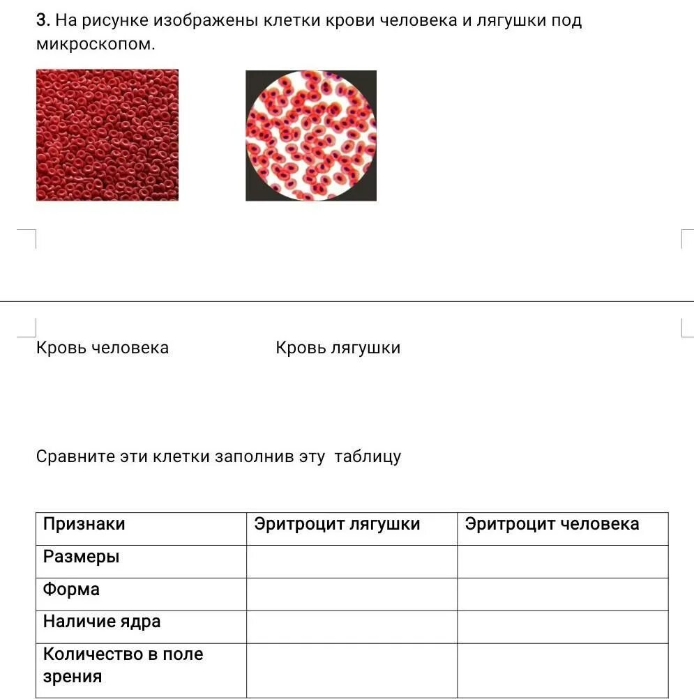 Лабораторная работа сравнение крови лягушки и человека. Кровь лягушки под микроскопом и кровь человека. Кровь человека и лягушки под микроскопом. Сравнение эритроцитов человека и лягушки таблица. Форма крови человека и лягушки.