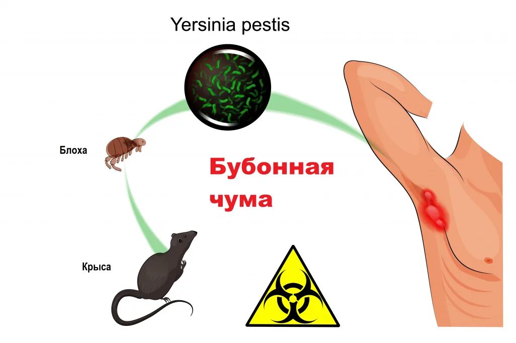 Чума является инфекцией