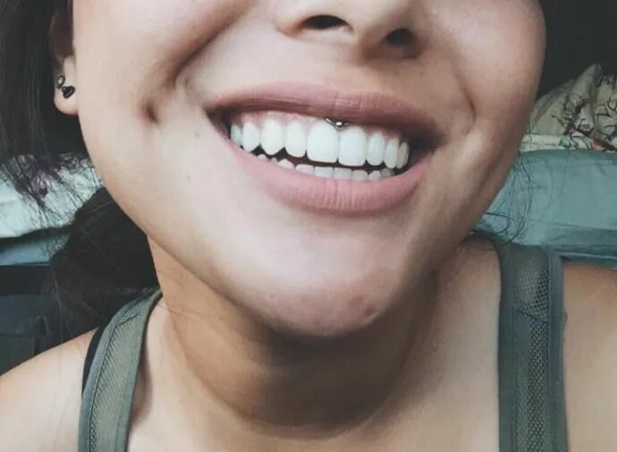 Как снять пирсинг смайл в домашних условиях Fresh smiley piercing by @mollymoonpierce #920tattoocompany #920tattooco #920tat