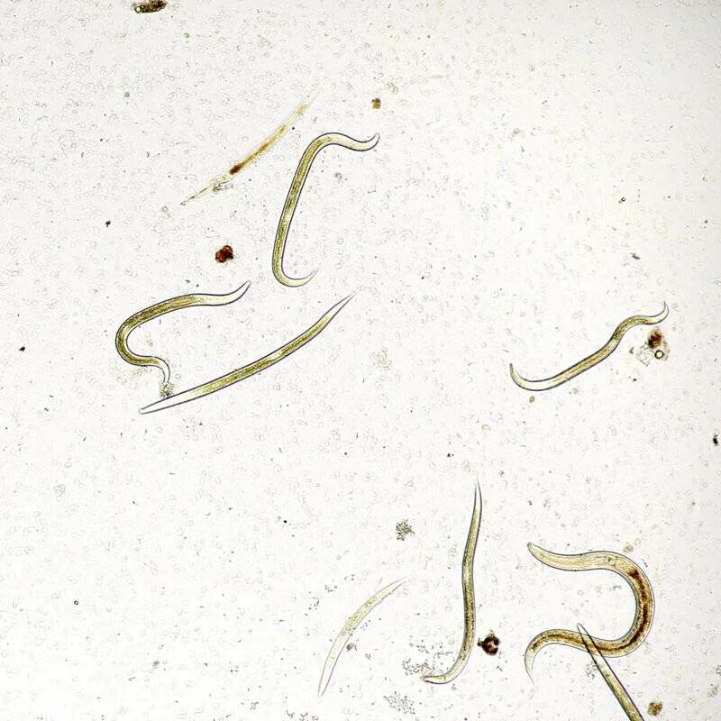 Нематоды паразитические черви. Аскариды острицы нематоды. Черные червячки острицы.