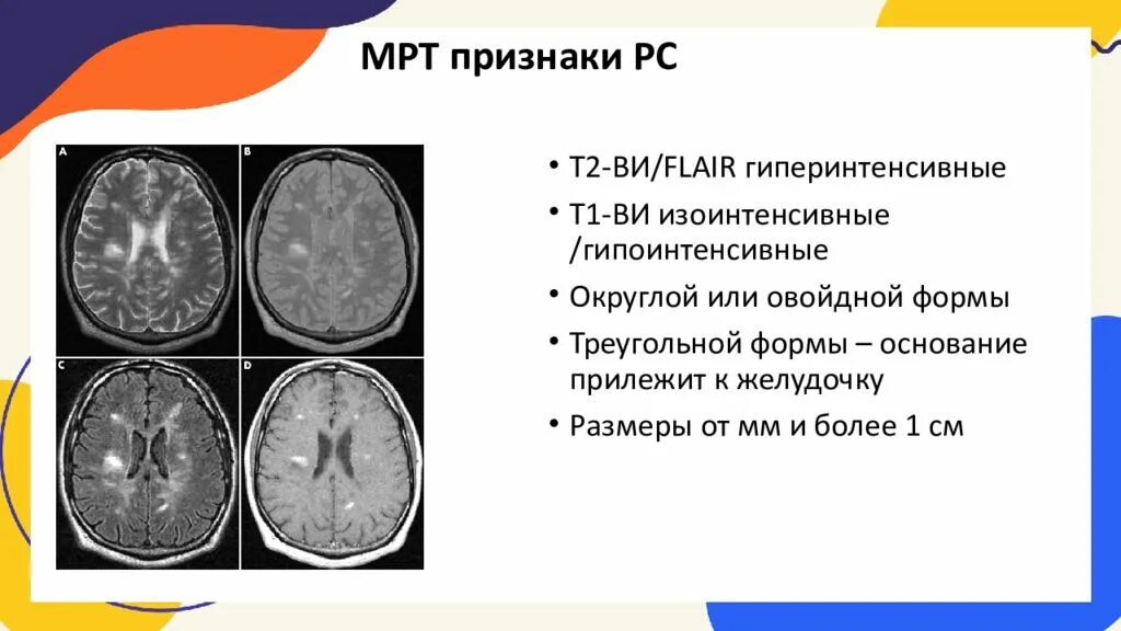 Очаг дистрофического характера в белом веществе. Очаг дистрофического характера в белом веществе. Формы обызвествления. Глиоз в сером веществе головного мозга. Патологическое обызвествление.