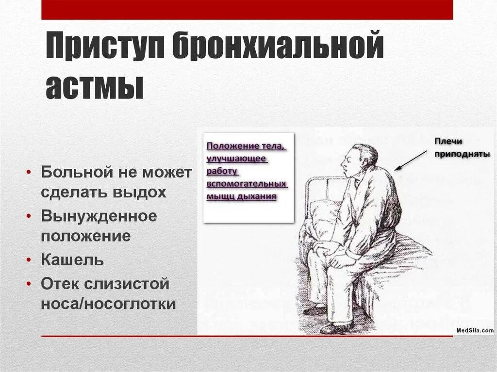 Положение принимаемое. Приступ бронхиальной астмы. приступ удушья при бронхиальной астме. положение больного при бронхиальной астме. положение при астматическом приступе.