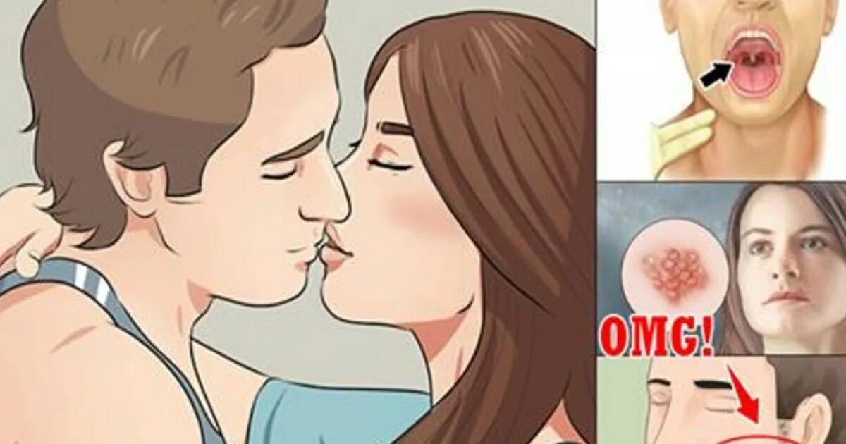 Через сколько можно целоваться. Виды поцелуев. Польза обнимашек и поцелуев. Как правильно целоваться с языком. Как научиться целоваться с языком.