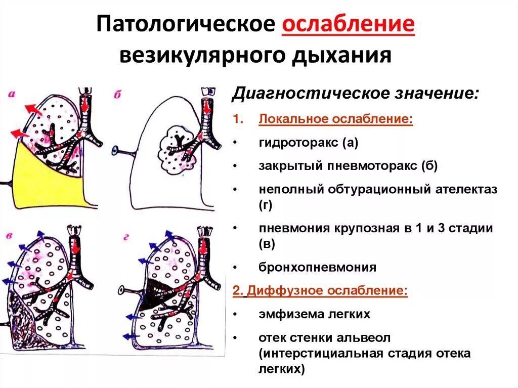 Аускультация везикулярное дыхание. Патологическое ослабление везикулярного дыхания. Причины ослабления везикулярного дыхания. Причины патологического ослабления везикулярного дыхания.