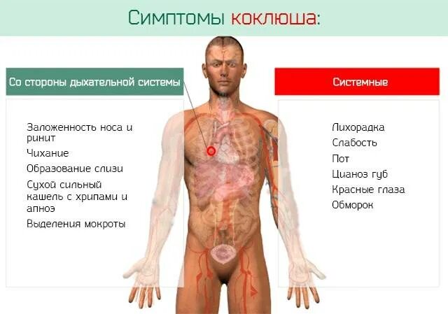Коклюш симптомы у подростка как лечить. Коклюш у детей клинические проявления. коклюш симптомы и синдромы. ведущий клинический симптом коклюша у детей.