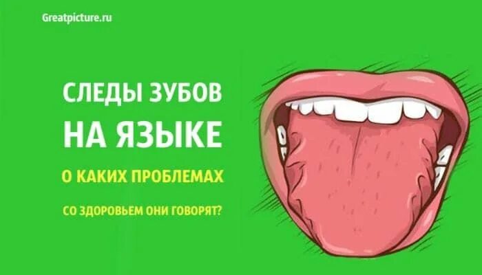След человека запах. Материальные и идеальные следы в криминалистике. Следы близкого выстрела на преградах. Русский след. Язык это след гигантского производительного.
