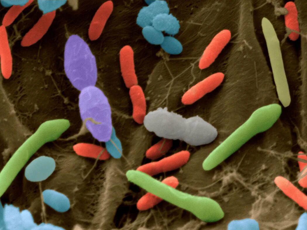 Три болезнетворные бактерии. Болезнетворные микробы. Смесь микроорганизмов. Микробы в фекалиях.