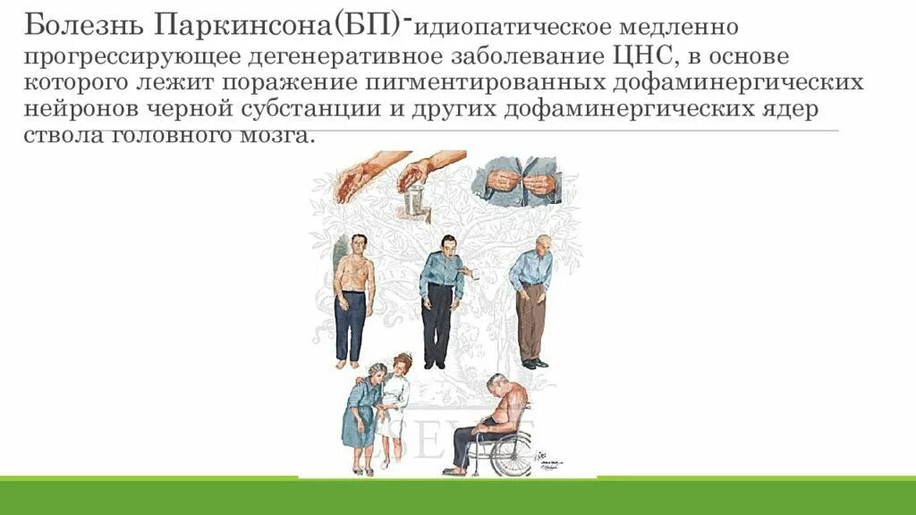 Болезнь паркинсона картинки. Паркинсон болезнь паркинсона. Болезнь паркинсона симптомы. Синдромы болезни паркинсона. Неофициальный паркинсон.